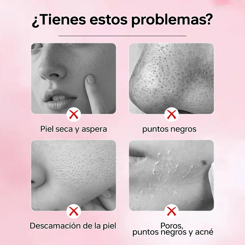 Gel Exfoliante QUARXERY con Hamamelis y Regaliz para Rostro 50g