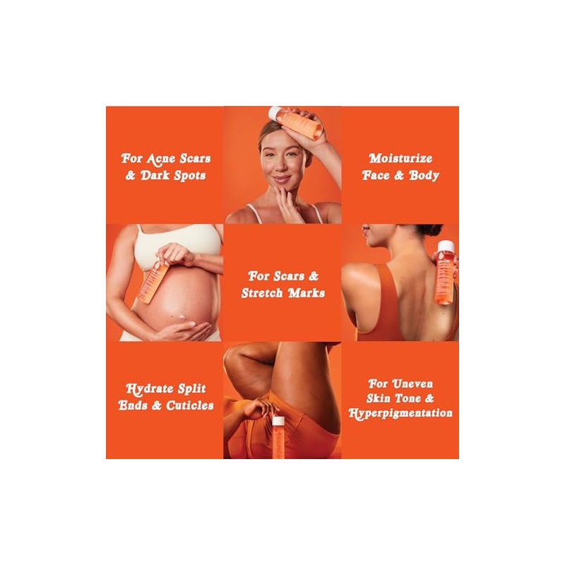 Bio-Oil® 6.7oz: Multiuse Skincare Oil