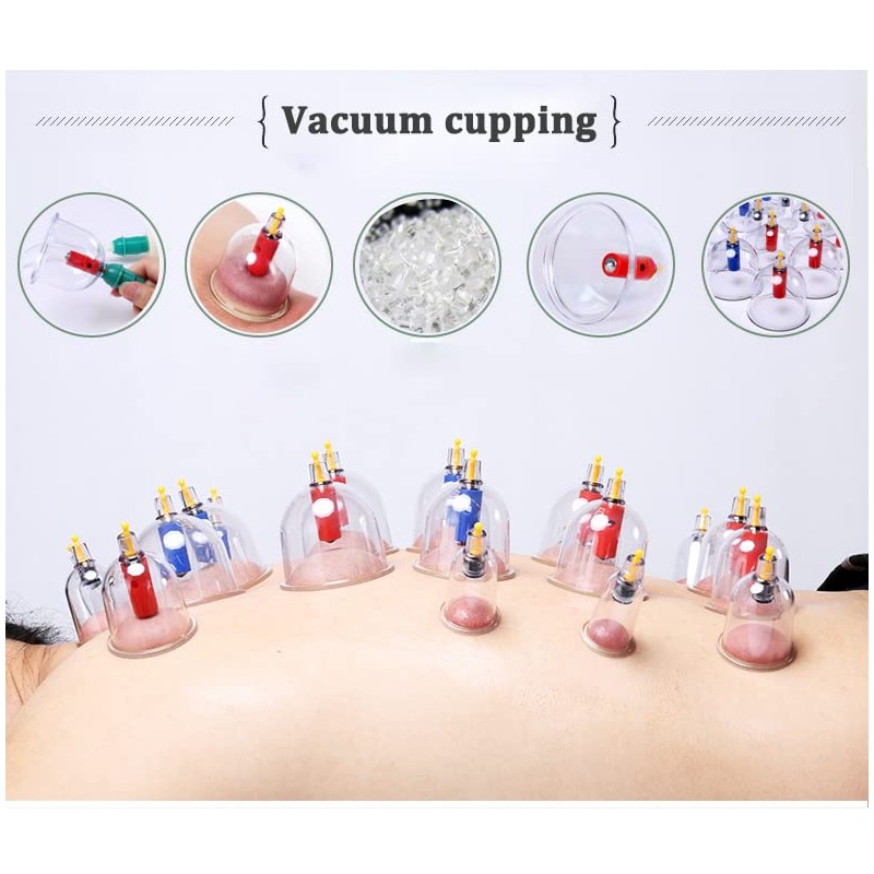 Kangzhu 24-Cup Biomagnetic Chinese Cupping Therapy Set