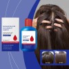 Champú Anticaspa Oil Control 300 Ml Scalp Nourish Para Hombr