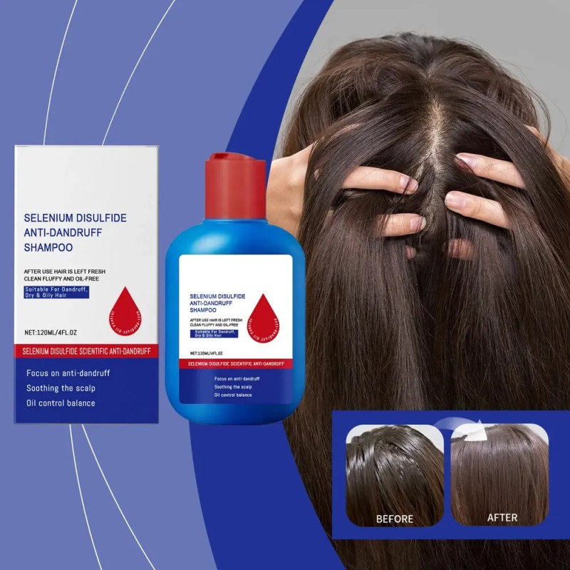 Champú Anticaspa Oil Control 300 Ml Scalp Nourish Para Hombr