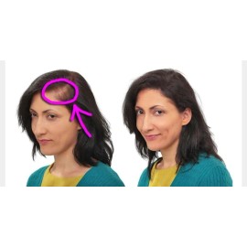 Shampoo Capilar Anticaida Para Dama, Regenerador Extremo