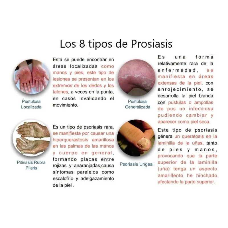 Pomada Nopsor Aux En El Tx De Psoriasis