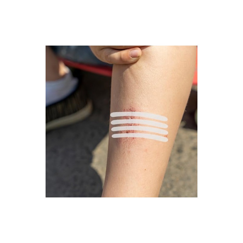 Pack of 32 Wound Fastening Strips 2 Sizes Wound Closure