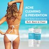 Butt Acne Clearing Treatment Cream: Clears & Prevents Breakouts Fast