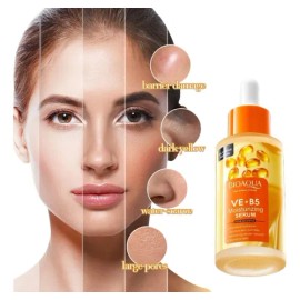 Serum Hydra B5 Y Vitamina E Quita Arrugas Patas De Gallo                                                                                              