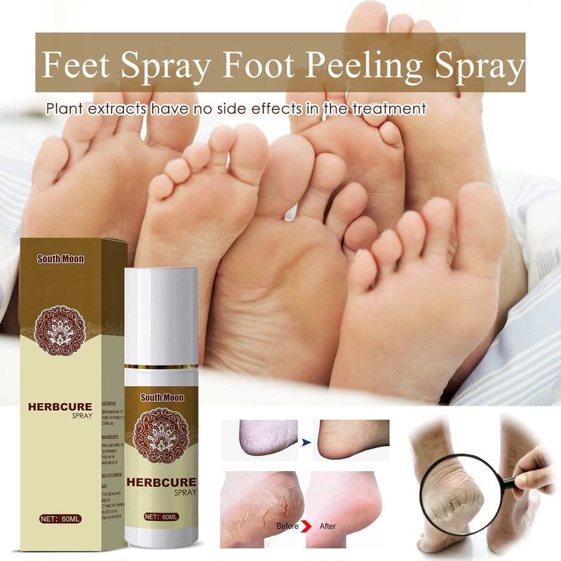 YG LianKai 3Pcs Feet Spray, Athlete's Foot Spray,Herbal Foot Peeling