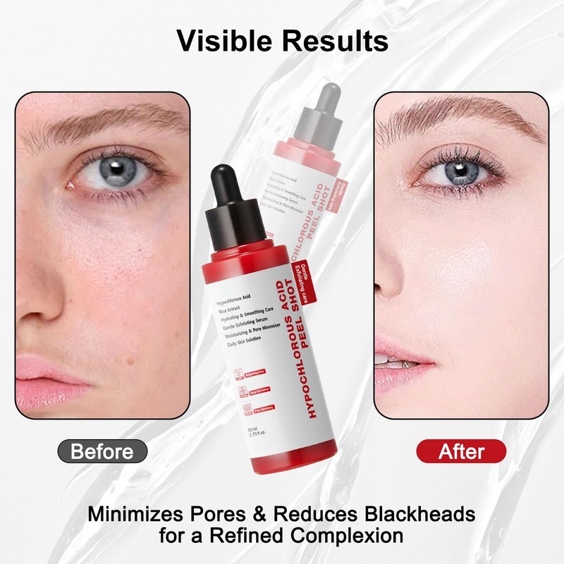 Gentle Exfoliating Serum with Hypochlorous Acid & Rice Extract -