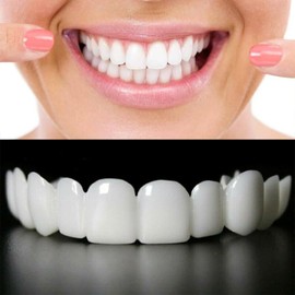 Snap-On Veneers - Professional DIY Smile Correction Kit for Men & Women - Comfortable, Natural White Top & Bottom Set - Perfect for Hiding Gaps, Stains & Missing Teeth - Easy Home Fit