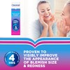 Clearasil Rapid Action Treatment Cream 25ml Pack of 3