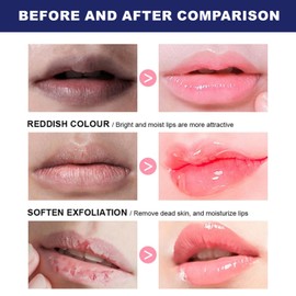 Lip Repair Ointment, Lip Balm Repair, Lip Repair Cream, Moisture to Soothe Dry Chapped Lips, Hydrating Moisturizing Repairs, Nourishing Care for Dry Cracked Lips