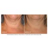 NEOSTRATA Skin Active Triple Firming Neck Cream 80g