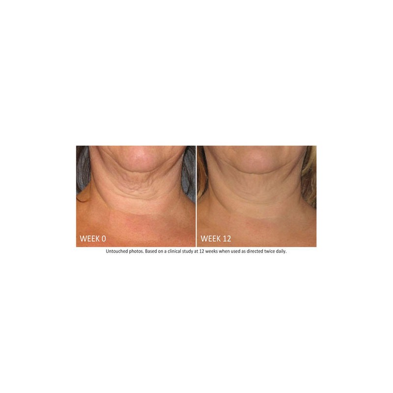NEOSTRATA Skin Active Triple Firming Neck Cream 80g