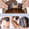 S-noilite Human Hair Toppers for Thinning Hair Women Real Hair