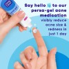 Clean & Clear, Persa-gel 10 Tratamiento Para Manchas De Acné