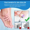 32 Parches Reparación Uñas + 1 Lampara Eliminar Hongos Pie