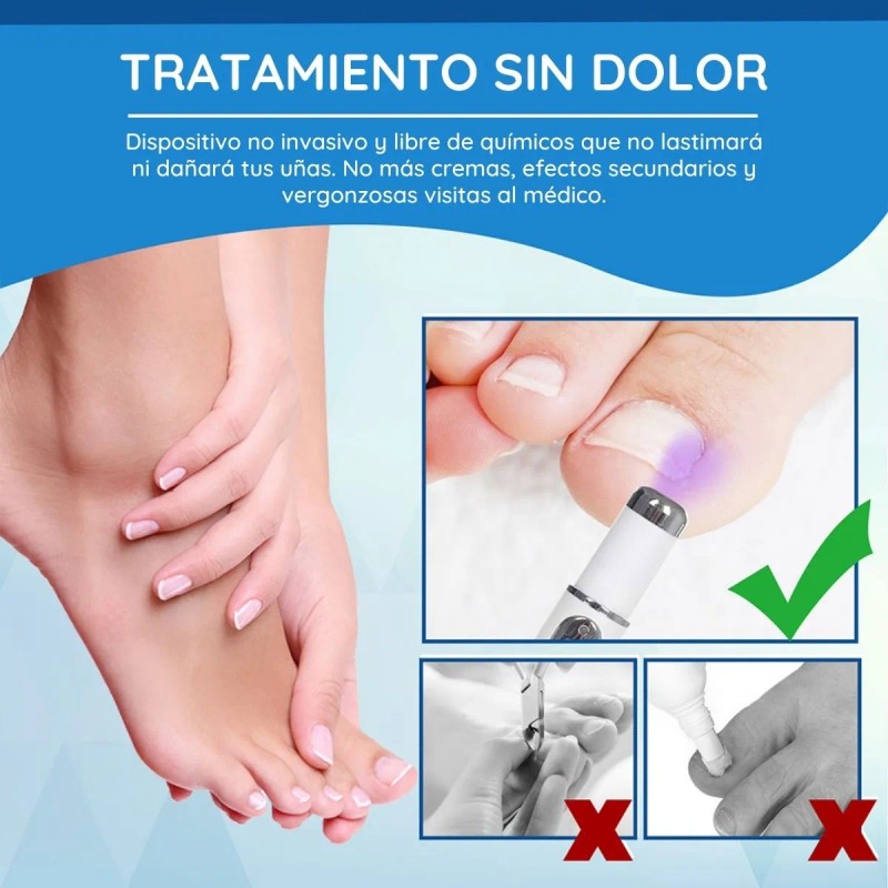 32 Parches Reparación Uñas + 1 Lampara Eliminar Hongos Pie