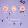 100% natural treatment of acne and reactive skin on the