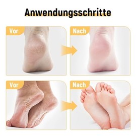 2025 Nuevo Crema Hidratante para Pies, Repara e Hidrata los Pies Secos y Agrietados, Exfoliating Moisturizing Foot Ointment, 40 ml (2)