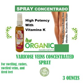 Le Varices Spray 4 onzas Vitamina K Hamamelis, Anti Varices para Venas Organico