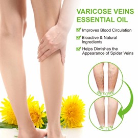 Varicose Veins Essential Oil, Spider Vein Removal Oil for Legs, Natural Varicose Veins Oils 30ML