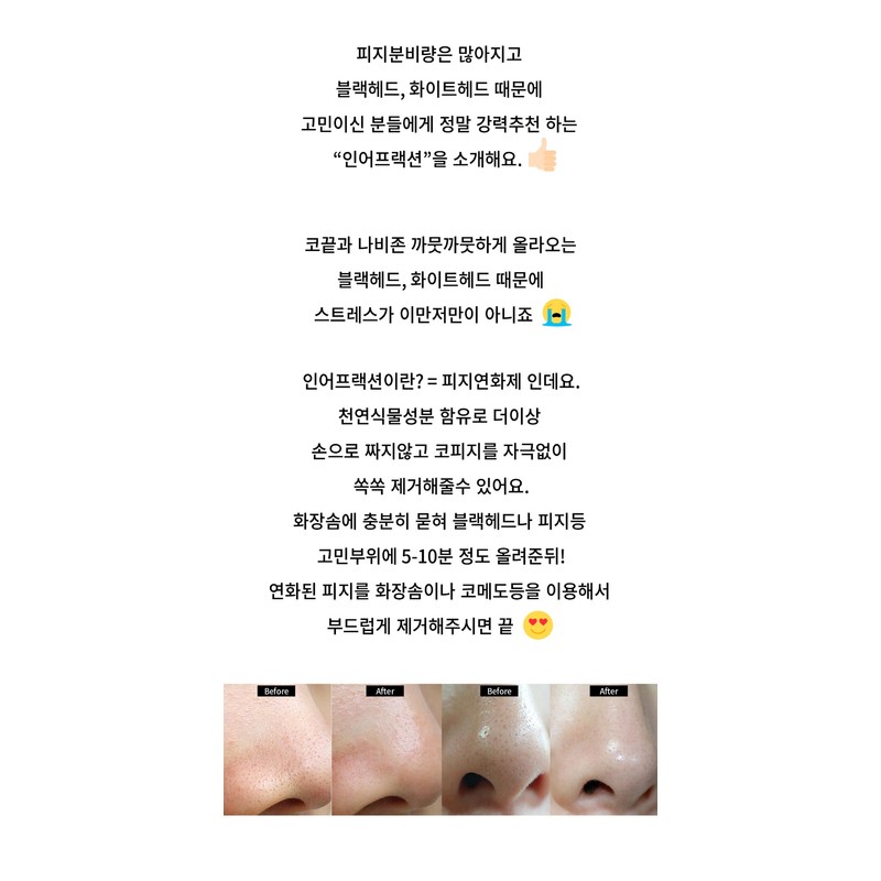 Mad Skin Extraction in a Fraction 120ml / 매드스킨 엑스트랙션