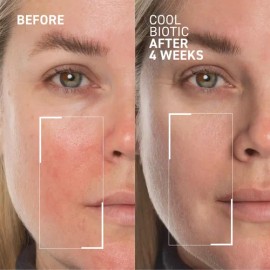 Crema Reductora Del Enrojecimiento Dr. Brandt Cool Biotic -                                                                                           
