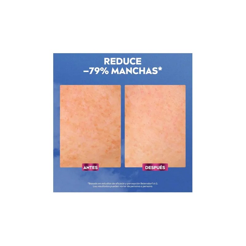 Nivea Luminous 630 Sérum Facial Anti-Manchas e Imperfecciones, 30 ml