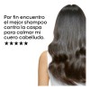 Shampoo Anti Irritacin LOral Professionnel Scalp 300ml