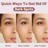 Crema Facial Despigmentante Y Aclarante 20g Todo Tipo De Piel