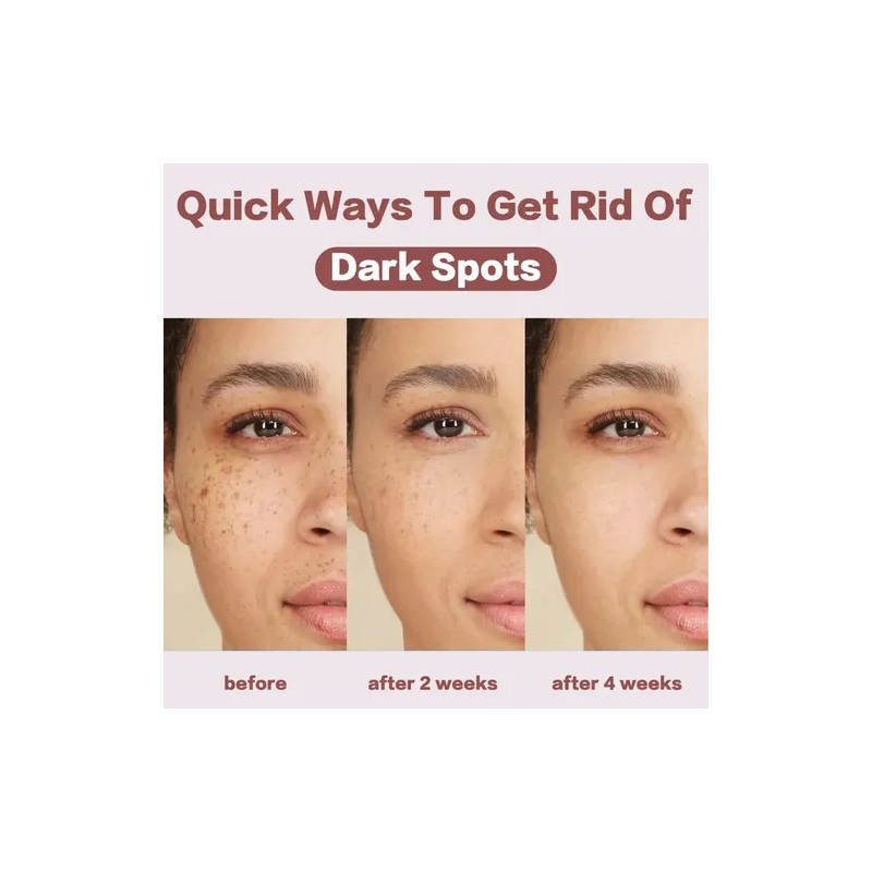 Crema Facial Despigmentante Y Aclarante 20g Todo Tipo De Piel