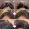 2 Pcs Hair Volume Clip for Fluffy Bangs, High Crown