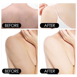 Beef Tallow Castor Oil Frankincense Balm,Beef Tallow for Skin,Grass-fed Be-ef Tall-ow with Franki-ncense Oil and Castor oil,B-eef Tallow Skin Care,Frankincense Oil for skin,Skin Tightening Cream Body