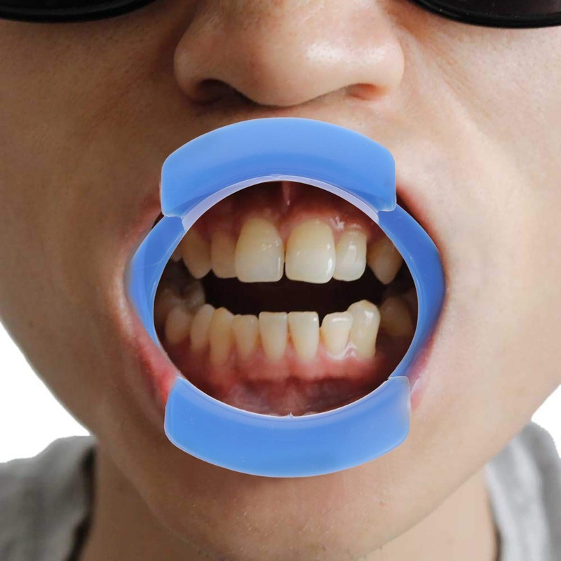 EXCEART 2 x Lip Opener, Teeth Retractor, Mouth Opener for