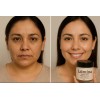 Crema Gel Hidratante Con Ácido Hialurónico Y Vitaminas