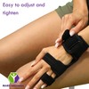 Mars Wellness Boxer Fracture Splint - 4th or 5th Metacarpal