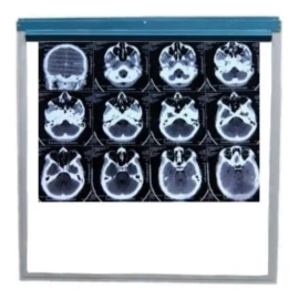 Innovaciones Medicas Negatoscopio Led 5000 Lumens Con Porta Radiografías De Acero