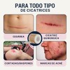 Over Lu DermaSilk™ | Cinta de Silicona para Cicatrices –