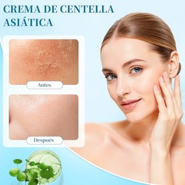 Crema Hidratante Centella Asiatica，hidratante facial，Cream Korean，hidratación profunda y reparadora，adecuada para todo tipo de piel,Mejora eficazmente