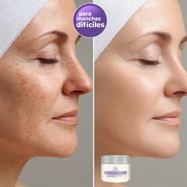 Crema Despigmentante Manchas Melasma Acné Paño 50g Todo Tipo Piel Noche