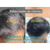 Shampoo Crecimiento Anticaida Raíz Serena | Romero Jengibre