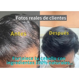 Shampoo Crecimiento Anticaida Raíz Serena | Romero Jengibre