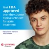 Adapalene Gel 0.1% Tratamiento Para El Acné, Crema Retinoide