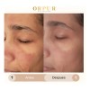 Crema Facial Hidratante Dermoaclaradora Anti Acne 4 Pack