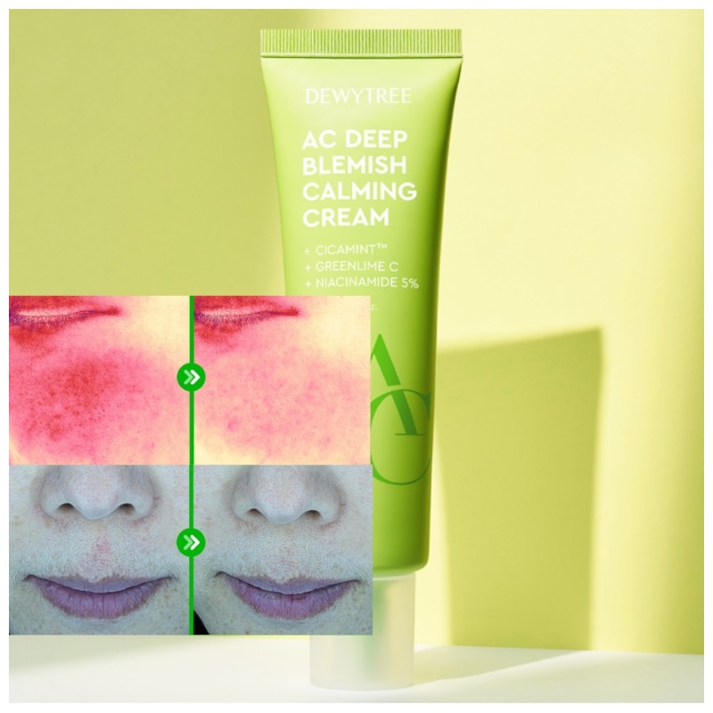 DEWYTREE AC Deep Blemish Calming Special Gift Set 5items [SUMMER
