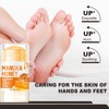 Honey Foot Cream for Very Dry Feet & Cracked Heels