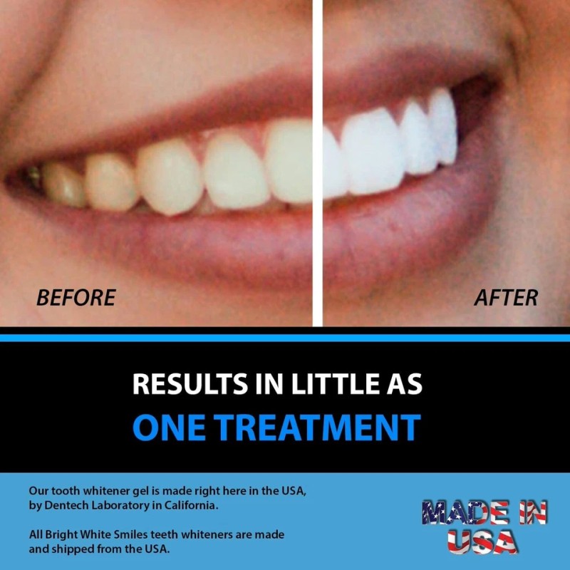 Teeth Whitening Gel 45% Peroxide – 10 Syringe Dental Whitening