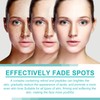 Facial Tallow Whitening Cream,Pigmentflecken Entferner,Entferner für dunkle Flecken verblasst Flecken,Gesichtspflege