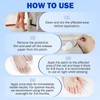 Fungal Nail Patches – 21 Pcs Multi-Purpose Toenail Repair Pads