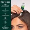Rene Furterer Triphasic Progressive Concentrated Serum for Hormonal, Hereditary Thinning